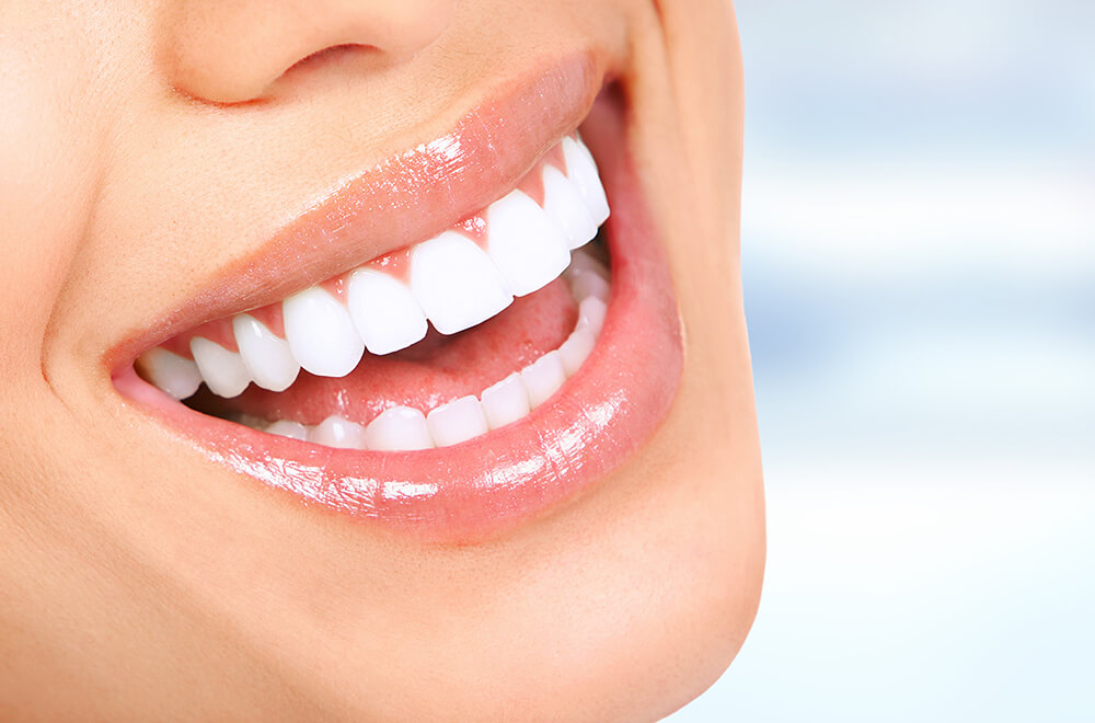 美しい笑顔を手に入れるなら、銀歯よりも「白い歯」
