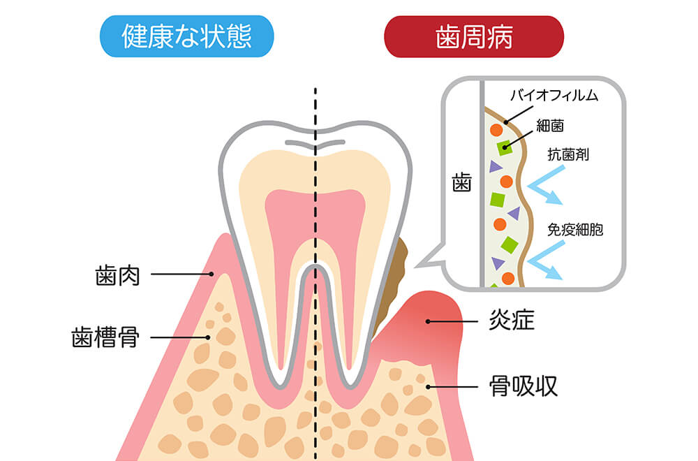 h4タイトルがはいりま